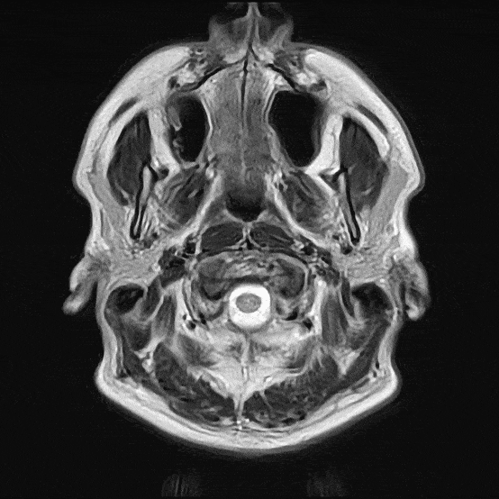 MRI Kopf, Gehirn & Schdel  Dauer, Befund & Ablauf